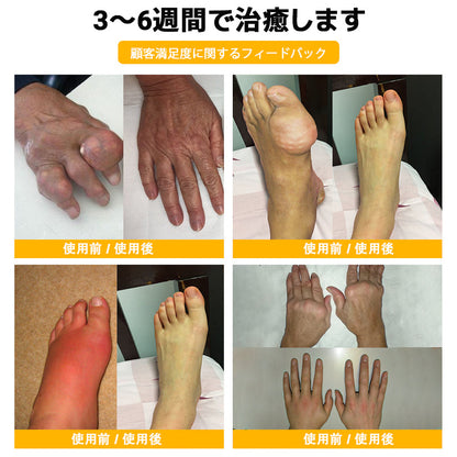 ZUWIAY® ハチ毒配合 痛み緩和・骨の治癒クリーム 🎊🎊（特に高齢者向け）