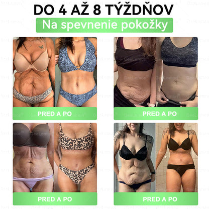 💕👩‍⚕️👩‍⚕️Odporúčané UNB · 👩‍⚕️Oficiálny obchod Dr. Max | 🎁 𝐆𝐞𝑒𝐿𝑒𝐦𝐨𝐧® Glumasetide 8 v 1 Nano mikrotŕňový náplasť – Len raz denne ✅ Viditeľné zmeny za 7 dní na obezitu, ochabnutú pokožku a zdravie